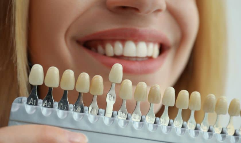 What Is The Significance Of Smile Makeovers In Cosmetic Dentistry?